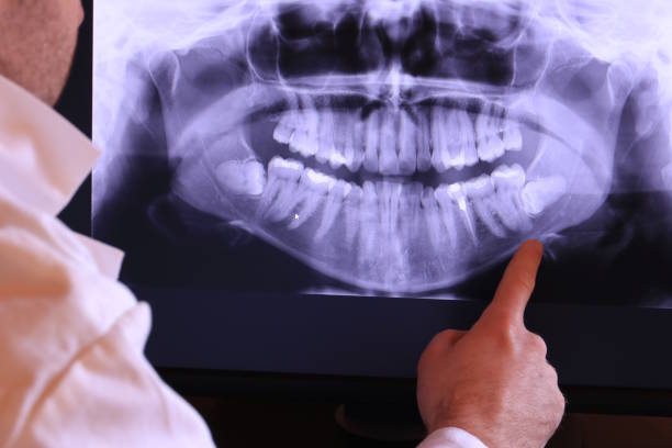 Best Emergency Treatment for Oral Infections in Mogadore, OH